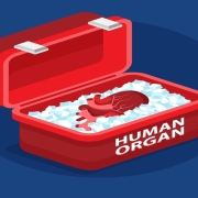 Human organ transport containers